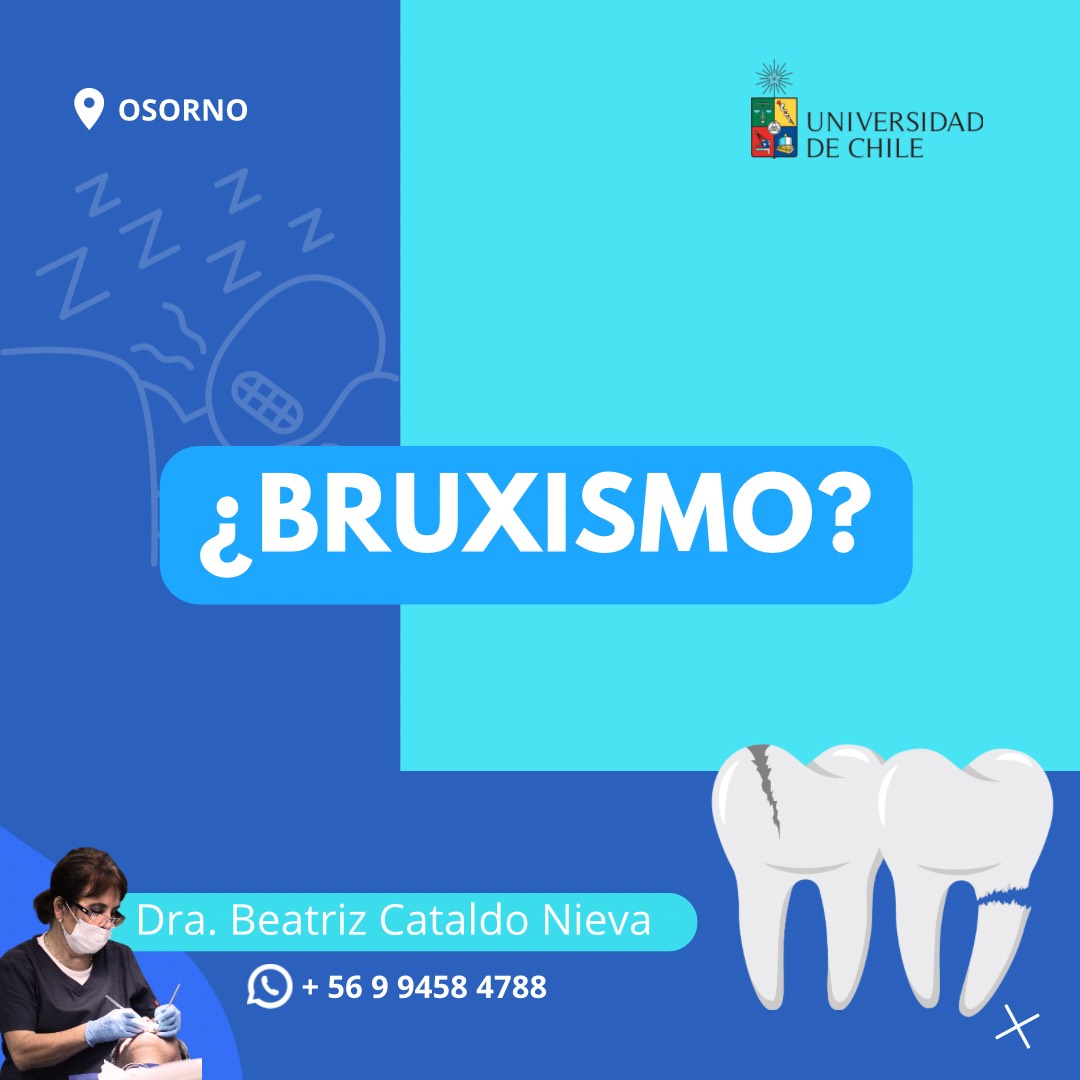 bruximo1